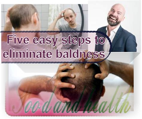 Success Stories: From Baldness to Luscious Locks