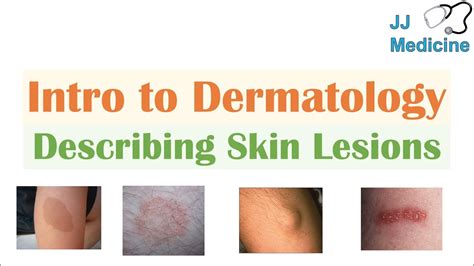 Tackling the Issue: Preventive Measures and Treatments for Dermatological Conditions