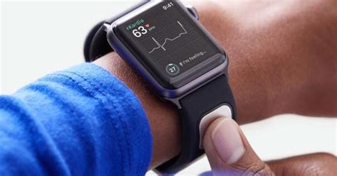 The Challenges of Accurately Monitoring Cardiovascular Activity on the Apple Smart Timepiece