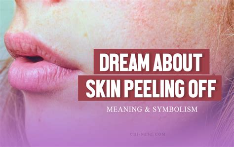 The Connection between Dreaming of Skin Peeling Off and Personal Transformation