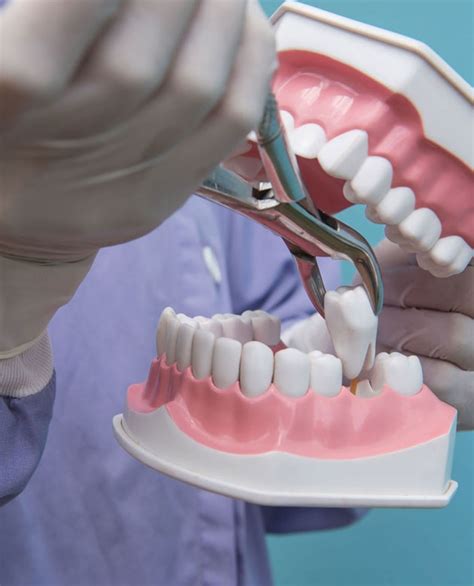 The Conventional Approach: Exploring the Process of Tooth Extraction and Its implications