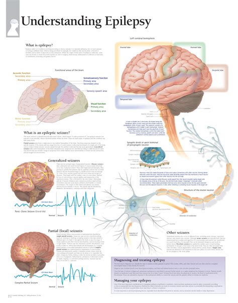 The Evolution of Epilepsy Understanding: Ancient Beliefs to Modern Science