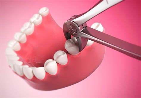 The Future of Dentistry: A Pain-Free Era for Tooth Extraction