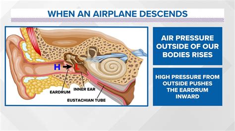 The Impact of Cabin Pressure on Eustachian Tube Equilibrium