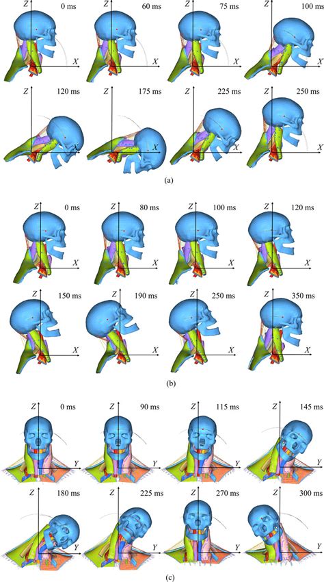 The Impact of Head Movements on Retention of Wired Earphones