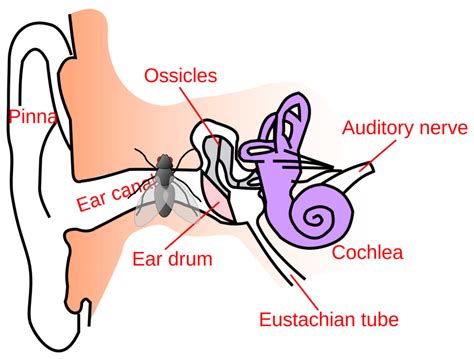The Intriguing Scenario of an Insect Trapped within the Auditory Canal