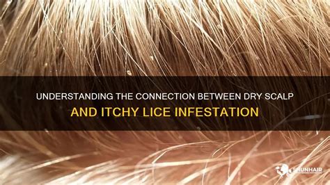 The Link between Lice Visions and Feelings of Insecurity