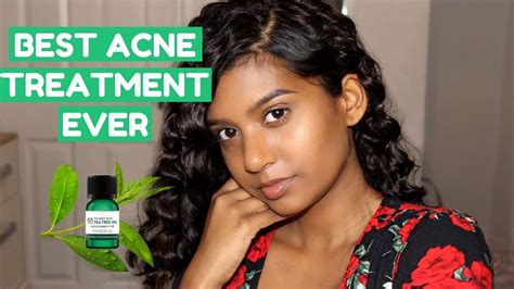The Power of Tea Tree Oil in Pimple Treatment