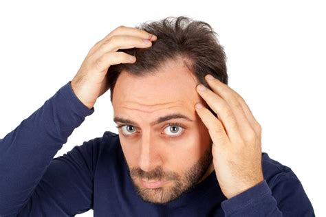 The Psychological Impact of Hair Thinning on Younger Individuals