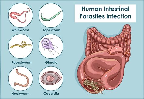 The Psychological Implications of Encountering Worms within One's Body during Dream States