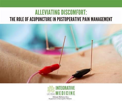 The Role of Acupuncture in Alleviating Labor Discomfort