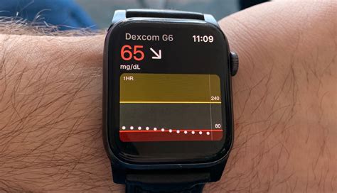 The Role of Apple Watch in Monitoring Health