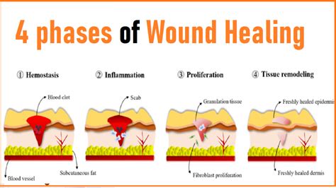 The Role of Communication in the Healing Process Following a Disheartening Act of Deceit