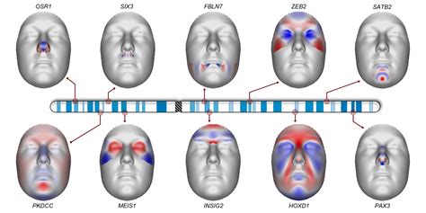 The Role of Genetics in Blushed Facial Skin among Children Eight Years Old