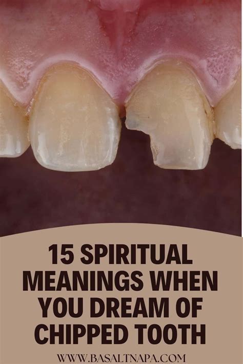 The Symbolic Significance of Dreaming About a Painlessly Dislodging Tooth