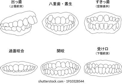 The Symbolism Behind Irregular Dentition in the Fantasies of Youngsters