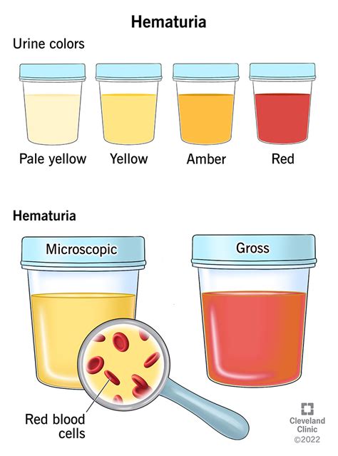 The Symbolism of Urine with Blood