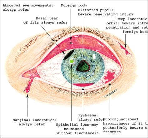 The Symbolism of the Injury in the Vision