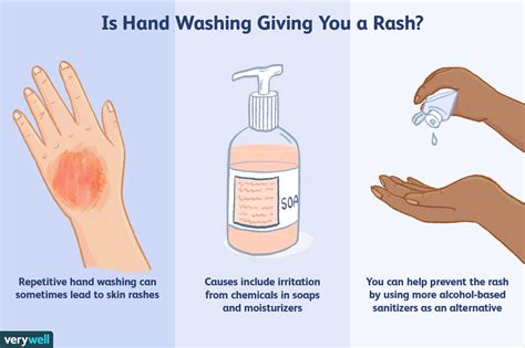 The impact of hand-washing on reducing allergy symptoms