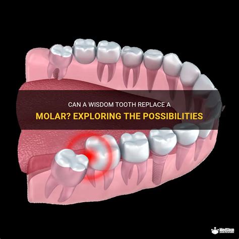 The potential for preserving an unstable tooth: Exploring the available possibilities