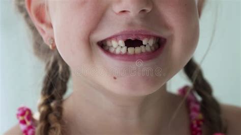 Traditions and Customs around Milk Tooth Loss