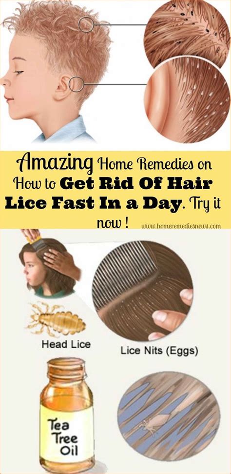 Treatment Options: Effective and Safe Methods to Eliminate Lice Infestation