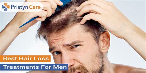 Treatment Options for Men Suffering from Hair Loss