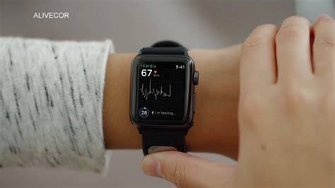 Troubleshooting frequent difficulties encountered when activating ECG on your wristwear device