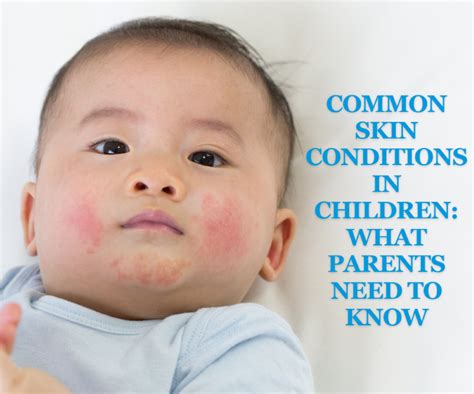 Understanding Childhood Skin Conditions