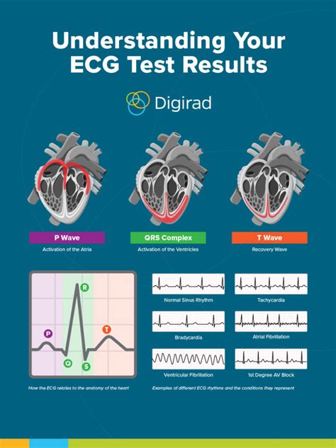 Understanding and Analyzing Your ECG Results