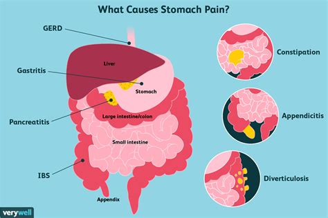 Understanding the Causes and Symptoms of a Severe Stomachache