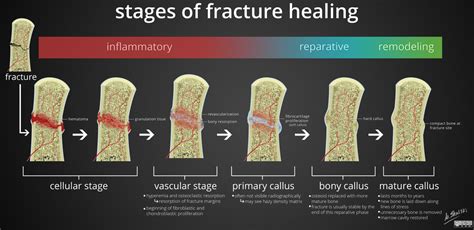 Understanding the Curative Process Represented by Fractured Windows in Oneiric Experiences