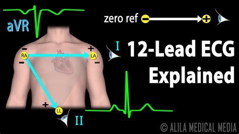 Understanding the ECG Functionality of your Timepiece