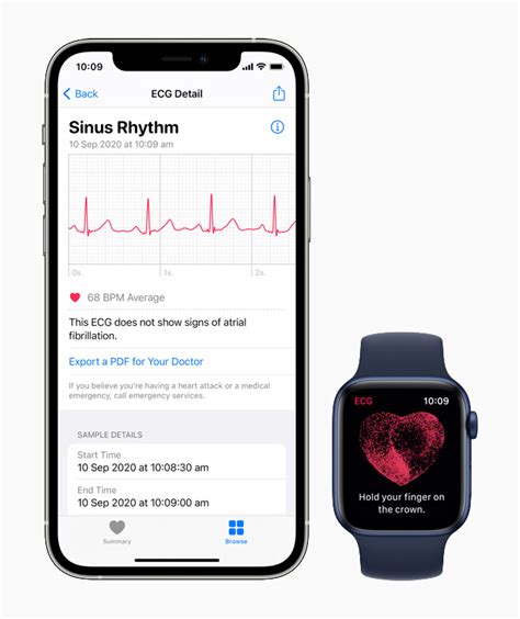 Understanding the Electrocardiogram (ECG) Functionality on the Apple Timepiece