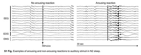 Understanding the Implication of a Toddler Submerging during Sleep