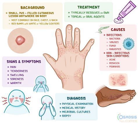 Understanding the Reasons Behind an Inflammatory and Pus-filled Lesion on the Hand