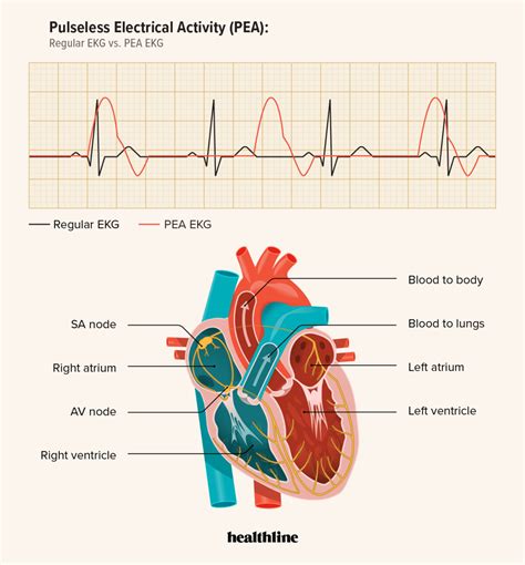 Understanding the Significance of Monitoring Your Heart's Electrical Activity