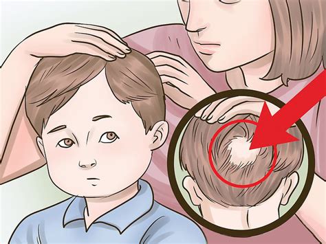 Understanding the Symbolism of Hair Loss in Children
