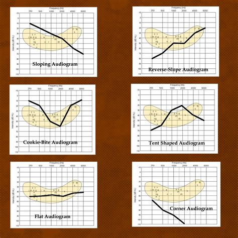 Understanding the Various Sound Configurations