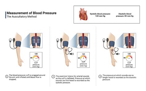 Understanding the concept of blood pressure measurement