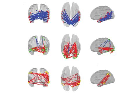 Unlocking the Patterns of the Mind: Unveiling the Repetitive Reveries