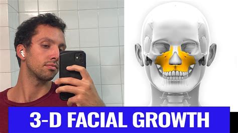 Unprecedented Magnitude: A Marvelous Discovery of an Enormous Facial Growth