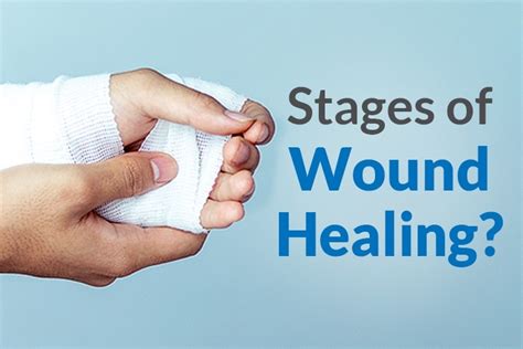 Unraveling the Remarkable Healing Powers: The Role of Juniper in Wound Healing and Infection Prevention