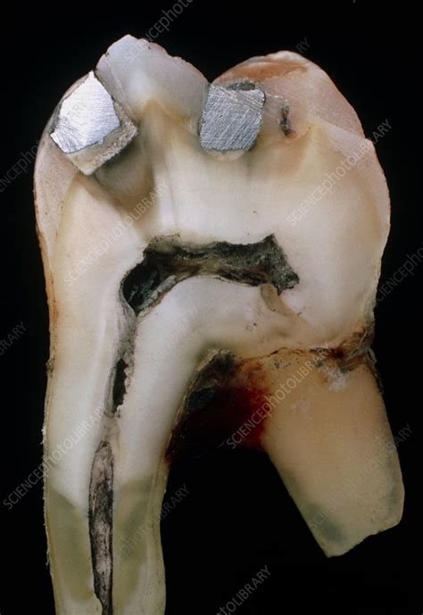 Unveiling the Enigma of Christ's Crimson Essence and its Pertinence to an Extracted Molar