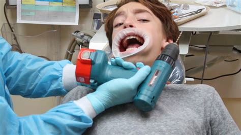 Unveiling the Hidden Messages of Agonizing Dental Nightmares