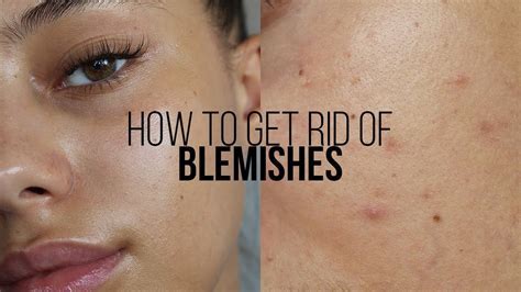 Using toothpaste to eliminate minor blemishes