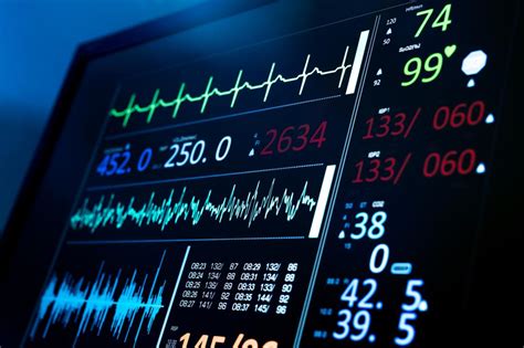 Utilizing ECG Data for Enhanced Health Monitoring